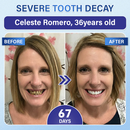 Your Smile🦷Ceoerty® Tooth & Gum Repair Fast-Dissolving Microneedle Patch✨ (𝟓-𝐢𝐧-𝟏 💎 𝐑𝐞𝐛𝐮𝐢𝐥𝐝 𝐄𝐧𝐚𝐦𝐞𝐥 & 𝐃𝐞𝐧𝐭𝐢𝐧 • 𝐒𝐭𝐫𝐞𝐧𝐠𝐭𝐡𝐞𝐧 𝐆𝐮𝐦𝐬 • 𝐄𝐫𝐚𝐝𝐢𝐜𝐚𝐭𝐞 𝐓𝐚𝐫𝐭𝐚𝐫 & 𝐎𝐝𝐨𝐫 • 𝐖𝐡𝐢𝐭𝐞𝐧𝐢𝐧𝐠 • 𝐒𝐭𝐨𝐩 𝐓𝐨𝐨𝐭𝐡 𝐒𝐞𝐧𝐬𝐢𝐭𝐢𝐯𝐢𝐭𝐲) (Copy)