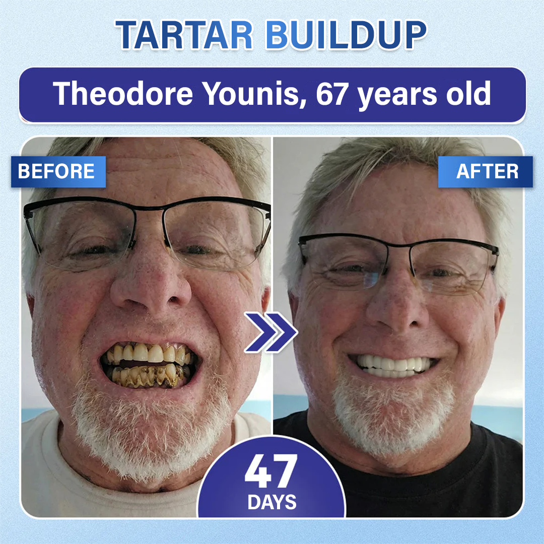 Your Smile🦷Ceoerty® Tooth & Gum Repair Fast-Dissolving Microneedle Patch✨ (𝟓-𝐢𝐧-𝟏 💎 𝐑𝐞𝐛𝐮𝐢𝐥𝐝 𝐄𝐧𝐚𝐦𝐞𝐥 & 𝐃𝐞𝐧𝐭𝐢𝐧 • 𝐒𝐭𝐫𝐞𝐧𝐠𝐭𝐡𝐞𝐧 𝐆𝐮𝐦𝐬 • 𝐄𝐫𝐚𝐝𝐢𝐜𝐚𝐭𝐞 𝐓𝐚𝐫𝐭𝐚𝐫 & 𝐎𝐝𝐨𝐫 • 𝐖𝐡𝐢𝐭𝐞𝐧𝐢𝐧𝐠 • 𝐒𝐭𝐨𝐩 𝐓𝐨𝐨𝐭𝐡 𝐒𝐞𝐧𝐬𝐢𝐭𝐢𝐯𝐢𝐭𝐲) (Copy)