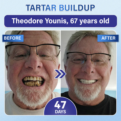 Your Smile🦷Ceoerty® Tooth & Gum Repair Fast-Dissolving Microneedle Patch✨ (𝟓-𝐢𝐧-𝟏 💎 𝐑𝐞𝐛𝐮𝐢𝐥𝐝 𝐄𝐧𝐚𝐦𝐞𝐥 & 𝐃𝐞𝐧𝐭𝐢𝐧 • 𝐒𝐭𝐫𝐞𝐧𝐠𝐭𝐡𝐞𝐧 𝐆𝐮𝐦𝐬 • 𝐄𝐫𝐚𝐝𝐢𝐜𝐚𝐭𝐞 𝐓𝐚𝐫𝐭𝐚𝐫 & 𝐎𝐝𝐨𝐫 • 𝐖𝐡𝐢𝐭𝐞𝐧𝐢𝐧𝐠 • 𝐒𝐭𝐨𝐩 𝐓𝐨𝐨𝐭𝐡 𝐒𝐞𝐧𝐬𝐢𝐭𝐢𝐯𝐢𝐭𝐲) (Copy)