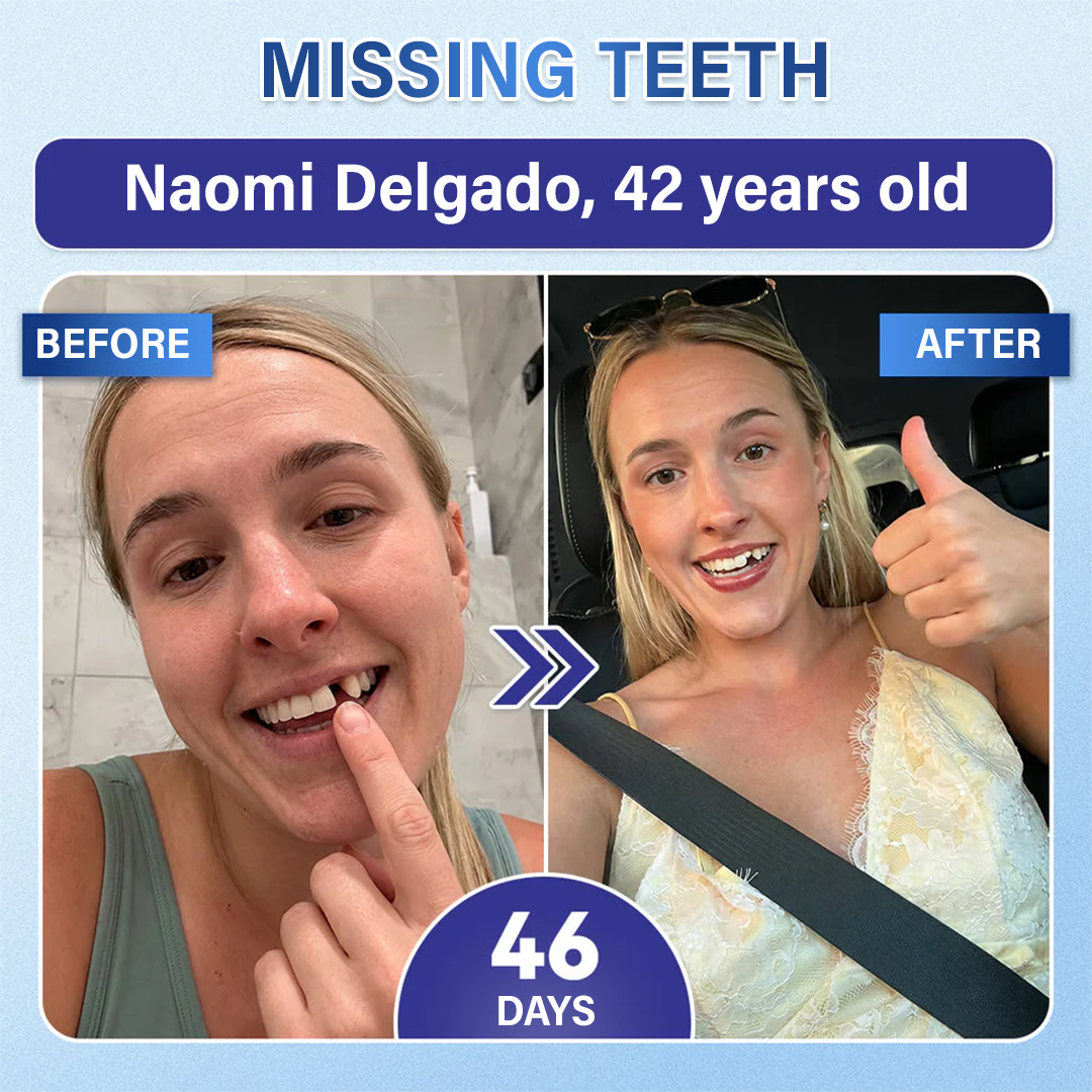 Your Smile🦷Ceoerty® Tooth & Gum Repair Fast-Dissolving Microneedle Patch✨ (𝟓-𝐢𝐧-𝟏 💎 𝐑𝐞𝐛𝐮𝐢𝐥𝐝 𝐄𝐧𝐚𝐦𝐞𝐥 & 𝐃𝐞𝐧𝐭𝐢𝐧 • 𝐒𝐭𝐫𝐞𝐧𝐠𝐭𝐡𝐞𝐧 𝐆𝐮𝐦𝐬 • 𝐄𝐫𝐚𝐝𝐢𝐜𝐚𝐭𝐞 𝐓𝐚𝐫𝐭𝐚𝐫 & 𝐎𝐝𝐨𝐫 • 𝐖𝐡𝐢𝐭𝐞𝐧𝐢𝐧𝐠 • 𝐒𝐭𝐨𝐩 𝐓𝐨𝐨𝐭𝐡 𝐒𝐞𝐧𝐬𝐢𝐭𝐢𝐯𝐢𝐭𝐲) (Copy)