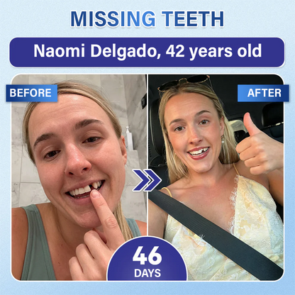Your Smile🦷Ceoerty® Tooth & Gum Repair Fast-Dissolving Microneedle Patch✨ (𝟓-𝐢𝐧-𝟏 💎 𝐑𝐞𝐛𝐮𝐢𝐥𝐝 𝐄𝐧𝐚𝐦𝐞𝐥 & 𝐃𝐞𝐧𝐭𝐢𝐧 • 𝐒𝐭𝐫𝐞𝐧𝐠𝐭𝐡𝐞𝐧 𝐆𝐮𝐦𝐬 • 𝐄𝐫𝐚𝐝𝐢𝐜𝐚𝐭𝐞 𝐓𝐚𝐫𝐭𝐚𝐫 & 𝐎𝐝𝐨𝐫 • 𝐖𝐡𝐢𝐭𝐞𝐧𝐢𝐧𝐠 • 𝐒𝐭𝐨𝐩 𝐓𝐨𝐨𝐭𝐡 𝐒𝐞𝐧𝐬𝐢𝐭𝐢𝐯𝐢𝐭𝐲) (Copy)