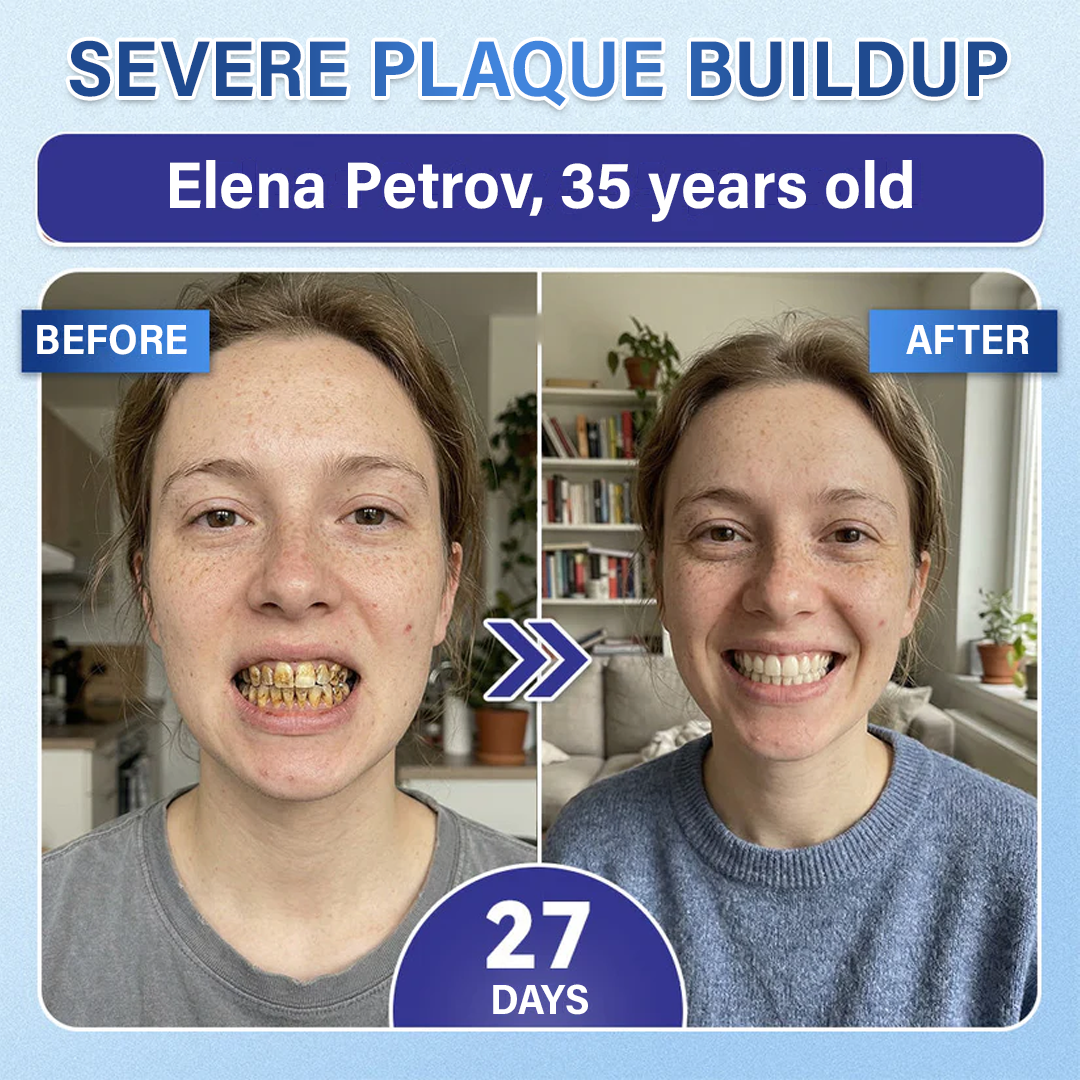 Your Smile🦷Ceoerty® Tooth & Gum Repair Fast-Dissolving Microneedle Patch✨ (𝟓-𝐢𝐧-𝟏 💎 𝐑𝐞𝐛𝐮𝐢𝐥𝐝 𝐄𝐧𝐚𝐦𝐞𝐥 & 𝐃𝐞𝐧𝐭𝐢𝐧 • 𝐒𝐭𝐫𝐞𝐧𝐠𝐭𝐡𝐞𝐧 𝐆𝐮𝐦𝐬 • 𝐄𝐫𝐚𝐝𝐢𝐜𝐚𝐭𝐞 𝐓𝐚𝐫𝐭𝐚𝐫 & 𝐎𝐝𝐨𝐫 • 𝐖𝐡𝐢𝐭𝐞𝐧𝐢𝐧𝐠 • 𝐒𝐭𝐨𝐩 𝐓𝐨𝐨𝐭𝐡 𝐒𝐞𝐧𝐬𝐢𝐭𝐢𝐯𝐢𝐭𝐲) (Copy)