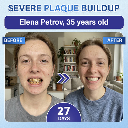 Your Smile🦷Ceoerty® Tooth & Gum Repair Fast-Dissolving Microneedle Patch✨ (𝟓-𝐢𝐧-𝟏 💎 𝐑𝐞𝐛𝐮𝐢𝐥𝐝 𝐄𝐧𝐚𝐦𝐞𝐥 & 𝐃𝐞𝐧𝐭𝐢𝐧 • 𝐒𝐭𝐫𝐞𝐧𝐠𝐭𝐡𝐞𝐧 𝐆𝐮𝐦𝐬 • 𝐄𝐫𝐚𝐝𝐢𝐜𝐚𝐭𝐞 𝐓𝐚𝐫𝐭𝐚𝐫 & 𝐎𝐝𝐨𝐫 • 𝐖𝐡𝐢𝐭𝐞𝐧𝐢𝐧𝐠 • 𝐒𝐭𝐨𝐩 𝐓𝐨𝐨𝐭𝐡 𝐒𝐞𝐧𝐬𝐢𝐭𝐢𝐯𝐢𝐭𝐲) (Copy)
