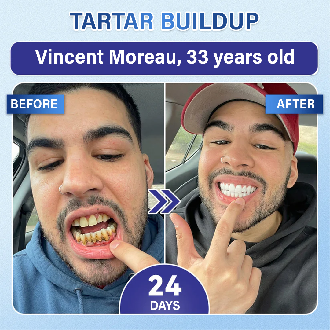 Your Smile🦷Ceoerty® Tooth & Gum Repair Fast-Dissolving Microneedle Patch✨ (𝟓-𝐢𝐧-𝟏 💎 𝐑𝐞𝐛𝐮𝐢𝐥𝐝 𝐄𝐧𝐚𝐦𝐞𝐥 & 𝐃𝐞𝐧𝐭𝐢𝐧 • 𝐒𝐭𝐫𝐞𝐧𝐠𝐭𝐡𝐞𝐧 𝐆𝐮𝐦𝐬 • 𝐄𝐫𝐚𝐝𝐢𝐜𝐚𝐭𝐞 𝐓𝐚𝐫𝐭𝐚𝐫 & 𝐎𝐝𝐨𝐫 • 𝐖𝐡𝐢𝐭𝐞𝐧𝐢𝐧𝐠 • 𝐒𝐭𝐨𝐩 𝐓𝐨𝐨𝐭𝐡 𝐒𝐞𝐧𝐬𝐢𝐭𝐢𝐯𝐢𝐭𝐲) (Copy)