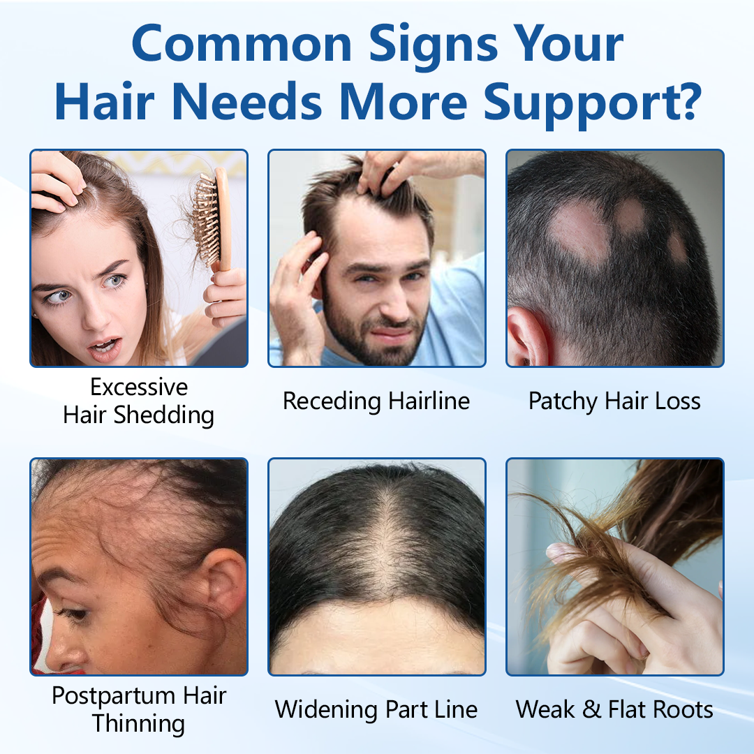 Ceoerty® RootVive Haarwuchsserum Roll-On