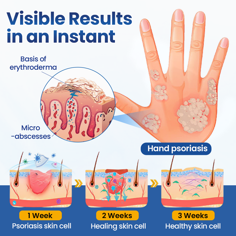 Cougex PsoriaMucin spray application visual