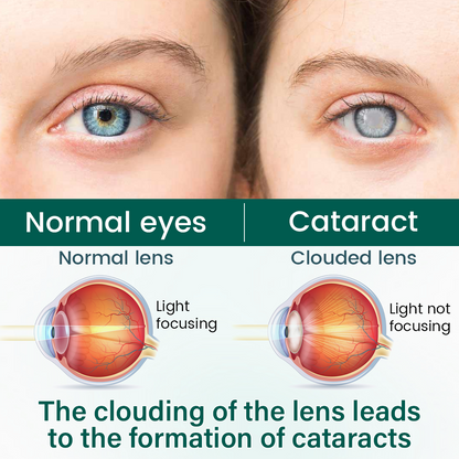 Ceoerty® OptiClear Nano Eye Roller Serum