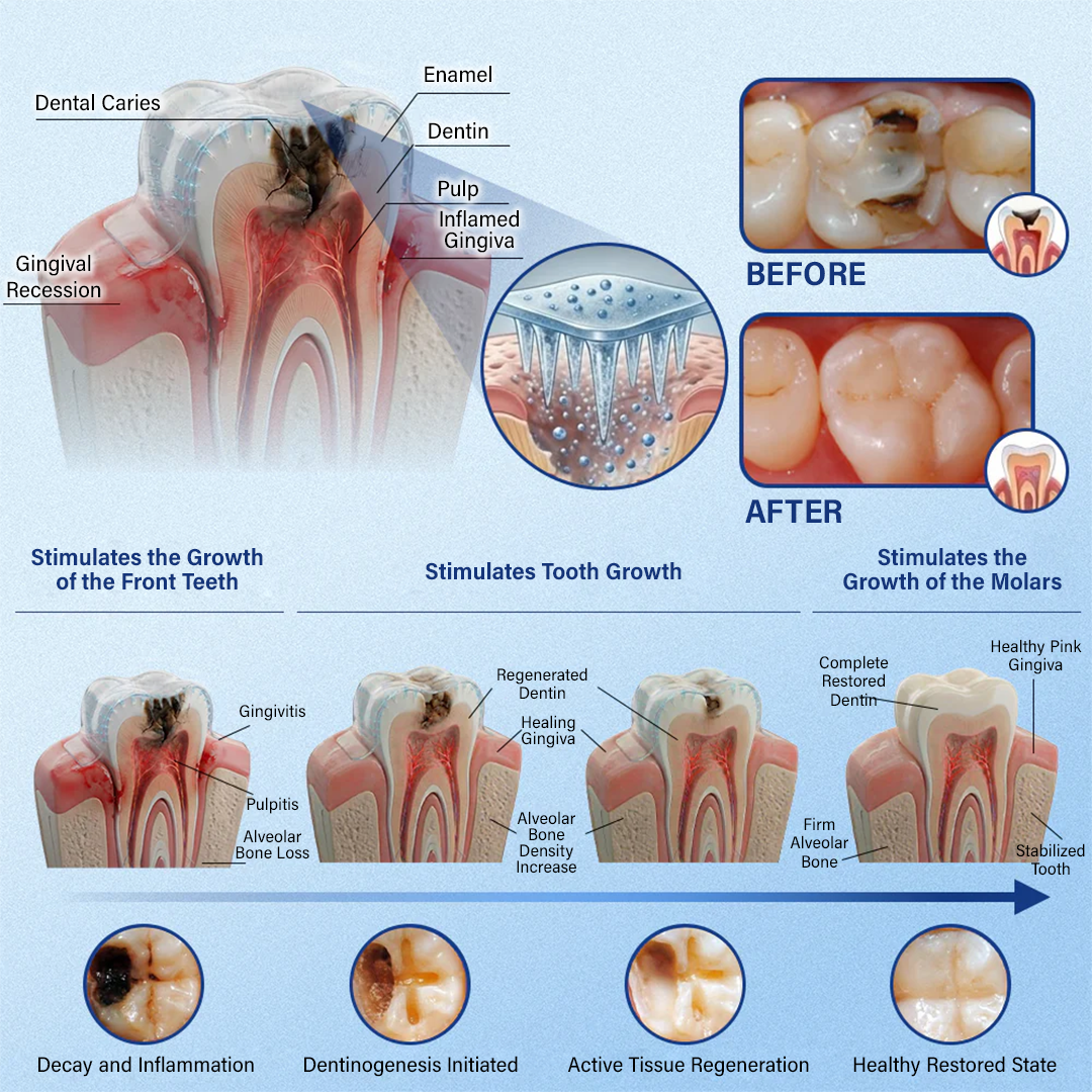 Your Smile🦷Ceoerty® Tooth & Gum Repair Fast-Dissolving Microneedle Patch✨ (𝟓-𝐢𝐧-𝟏 💎 𝐑𝐞𝐛𝐮𝐢𝐥𝐝 𝐄𝐧𝐚𝐦𝐞𝐥 & 𝐃𝐞𝐧𝐭𝐢𝐧 • 𝐒𝐭𝐫𝐞𝐧𝐠𝐭𝐡𝐞𝐧 𝐆𝐮𝐦𝐬 • 𝐄𝐫𝐚𝐝𝐢𝐜𝐚𝐭𝐞 𝐓𝐚𝐫𝐭𝐚𝐫 & 𝐎𝐝𝐨𝐫 • 𝐖𝐡𝐢𝐭𝐞𝐧𝐢𝐧𝐠 • 𝐒𝐭𝐨𝐩 𝐓𝐨𝐨𝐭𝐡 𝐒𝐞𝐧𝐬𝐢𝐭𝐢𝐯𝐢𝐭𝐲) (Copy)